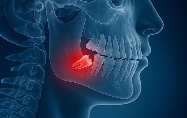 서울이로운치과 일반진료
